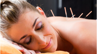 Woman lying down with dry needles in her upper back getting treatment